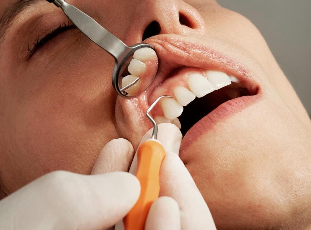 PROBLEMAS DE ENCIAS DENTISTA SONSECA