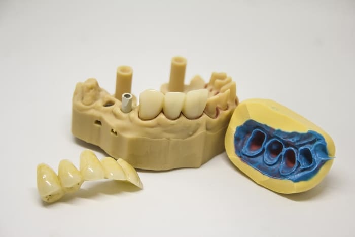 PROTESIS DENTAL EN SONSECA